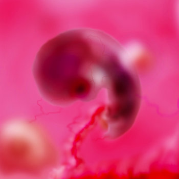 Housefly cover art