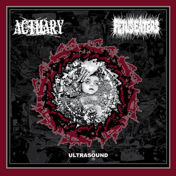 ULTRASOUND cover art