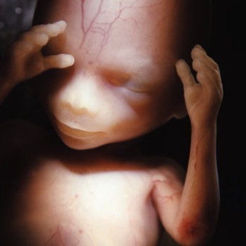 Conception cover art