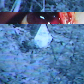 Gouge Your Eyes Out cover art