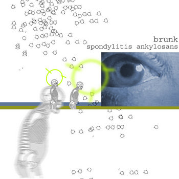 spondylitis ankylosans cover art